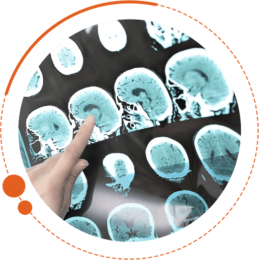 A person is touching the image of an mri.