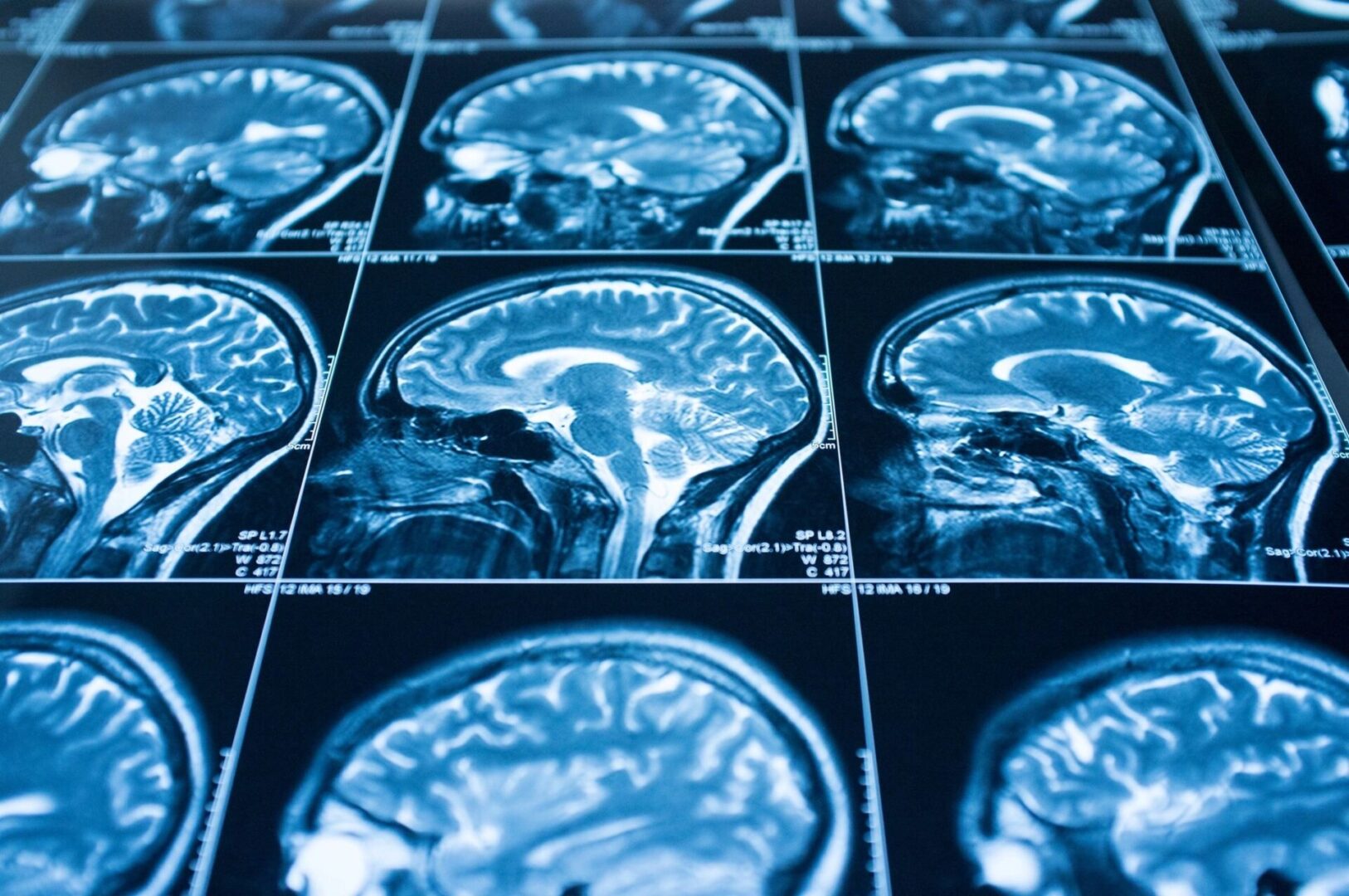 A close up of many different types of brain scans